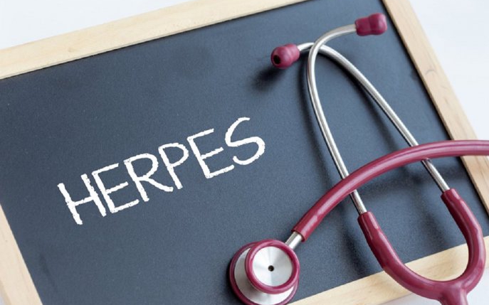 Tratamente care te scapă de herpesul bucal