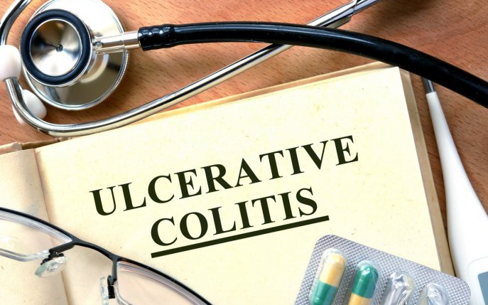 Colita ulcerativă: cauze, simptome, tratament