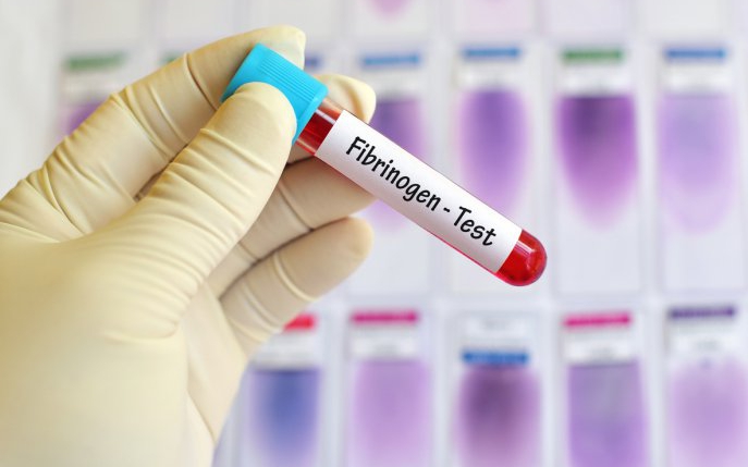 Fibrinogen crescut: cauze, simptome și tratament
