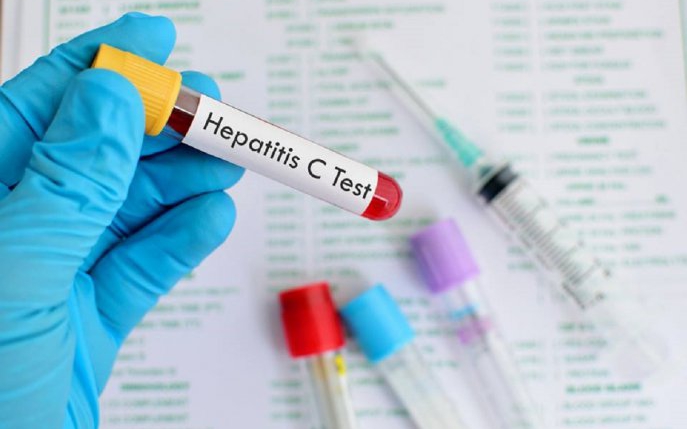 Dieta în hepatita C: ce să mănânci şi ce să eviţi