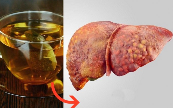Atenţie: acest ceai te poate îmbolnăvi de hepatită