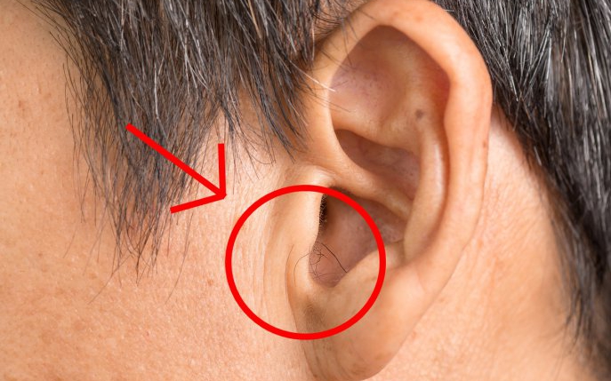 Ce boală prevestește părul din urechi