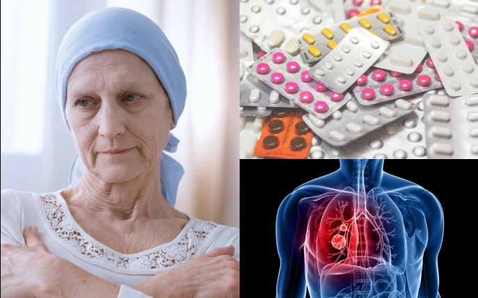 Alertă medicală! Aceste pastile de tensiune cresc riscul de cancer pulomonar