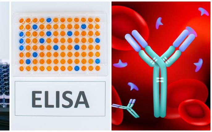 Cât costă testul ELISA în România