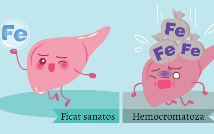 Hemocromatoza: cauze, simptome și tratament