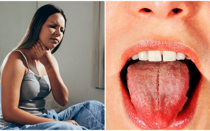 7 cauze pentru care ai gura uscată