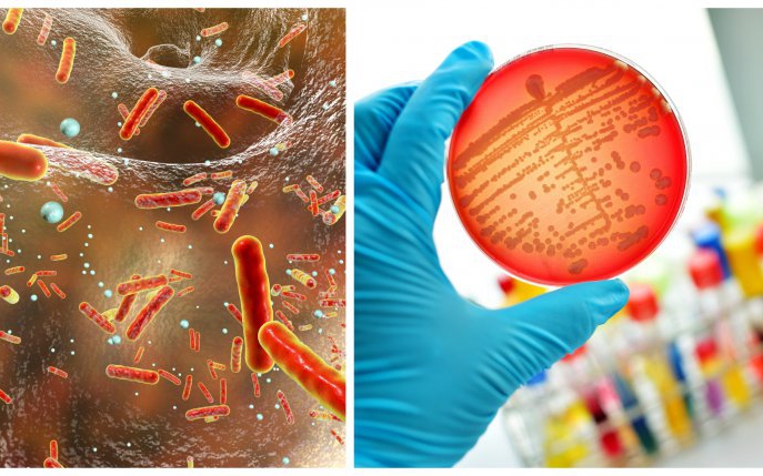 Acinetobacter: tot ce trebuie să știi despre bacteria ucigașă de la Institutul „Marius Nasta”