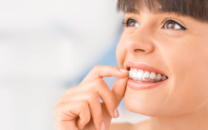 Cât costă să îți pui un aparat dentar în România, în 2020