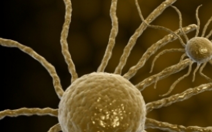 Cancerul - simptome, diagnostic si tratament