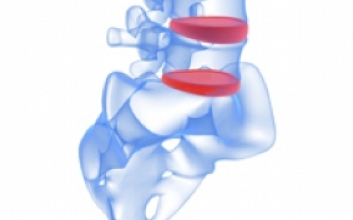 Hernia - simptome, diagnostic si tratament