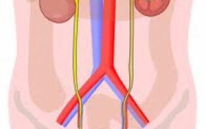 Cancerul de vezica - cauze, diagnostic si tratament