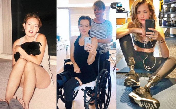 Incredibila poveste de viață a lui Amy Purdy, sportiva de performanță fără picioare