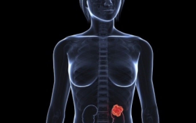 Insuficienta renala acuta - simptome, diagnostic, tratament