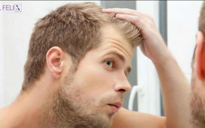 Întrebări frecvent cu privire la implantul de păr. La cabinetul Dr. Felix găsiți răspunsuri
