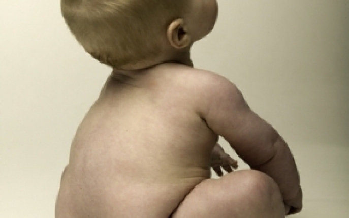 Spina bifida - tipuri, simptome si diagnostic