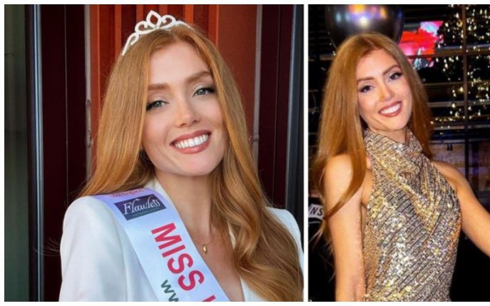 A fost o victimă a bullying-ului când era copil, dar a ajuns prima Miss Anglia roșcată