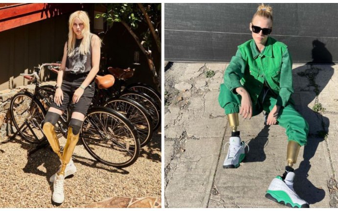 Povestea incredibilă a modelului care a rămas fără picioare din cauza unui tampon. A sfidat toate piedicile puse de soartă