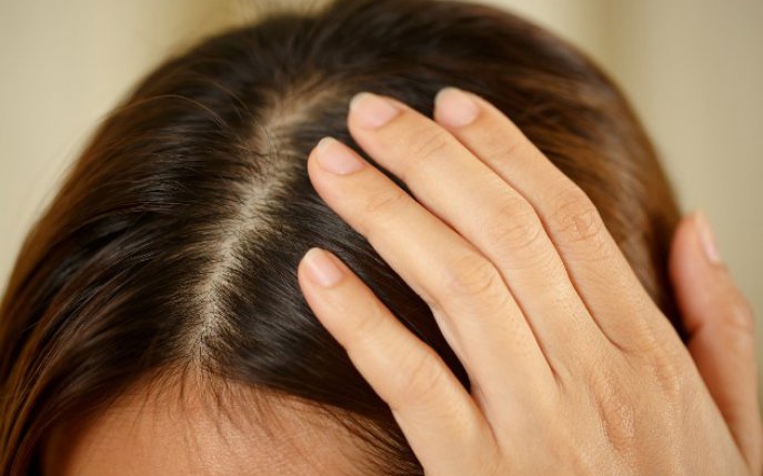 Ai grijă de păr, dar cu scalpul cum rămâne? Uite de ce este importantă îngrijirea corectă a scalpului