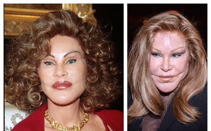 Supranumită "femeia pisică", Jocelyn Wildenstein și-a schimbat radical înfățișarea după zeci de operații estetice. Uite cum arată acum