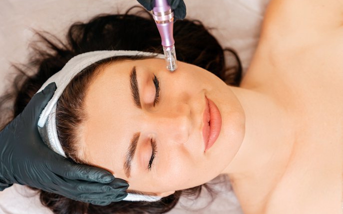 Microneedling: ce presupune și cum îți ajută pielea