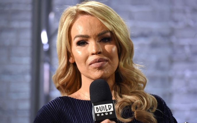 Există viață după tragedie! Ce se întâmplă acum cu prezentatoarea TV care a fost desfigurată cu acid sulfuric de fostul iubit