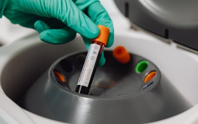 Indicele HOMA: ce este și când este recomandată testarea