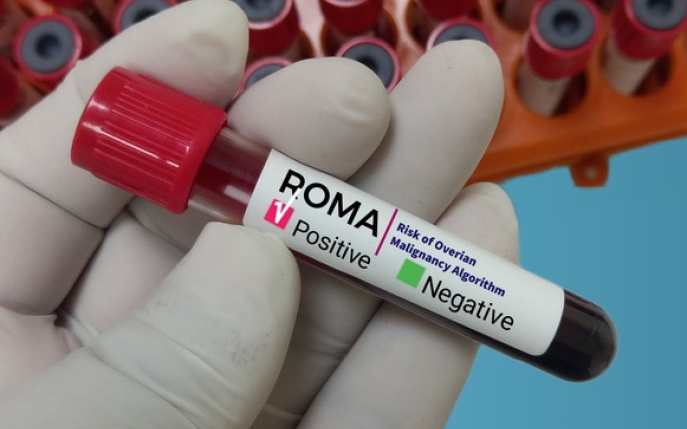 Scorul Roma: ce este și de ce este important