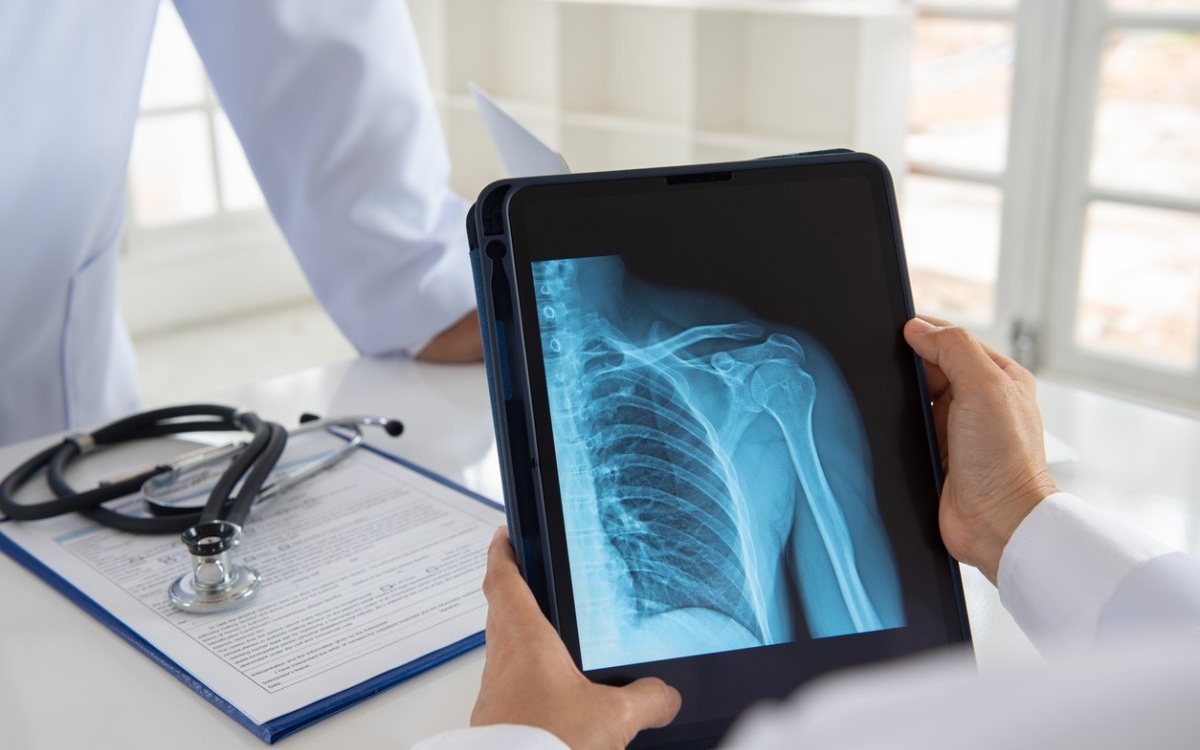 Cât costă un test de osteoporoză în 2024 și de ce ar trebui să îl faci