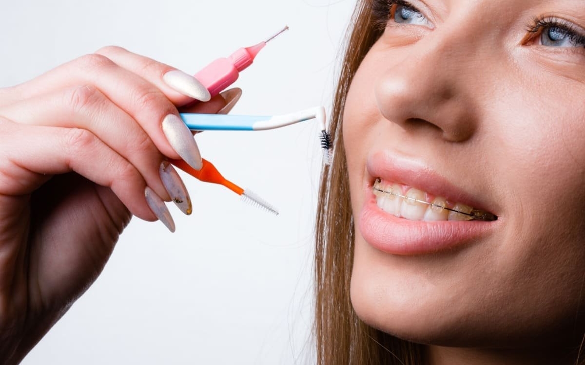 Tipuri de aparate dentare: care este cel mai potrivit pentru nevoile tale?