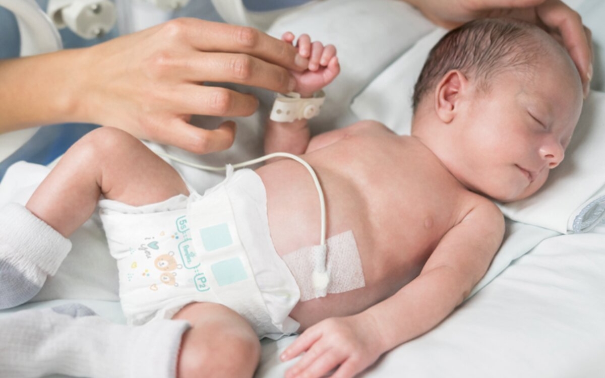 Pampers continuă să fie alături de micii luptători prin donația de scutece Pampers special concepute pentru prematuri
