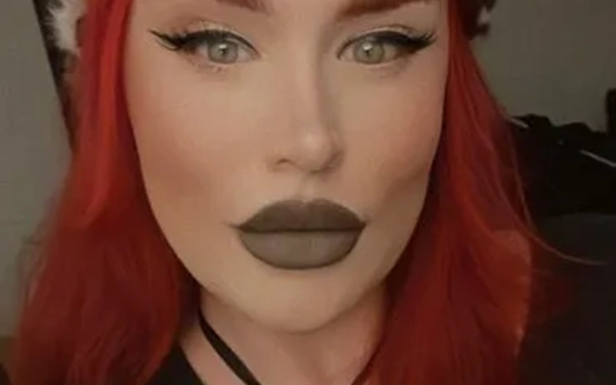 O femeie de 31 de ani a fost în comă timp de 7 săptămâni după ce a folosit o substanță injectabilă pentru slăbit