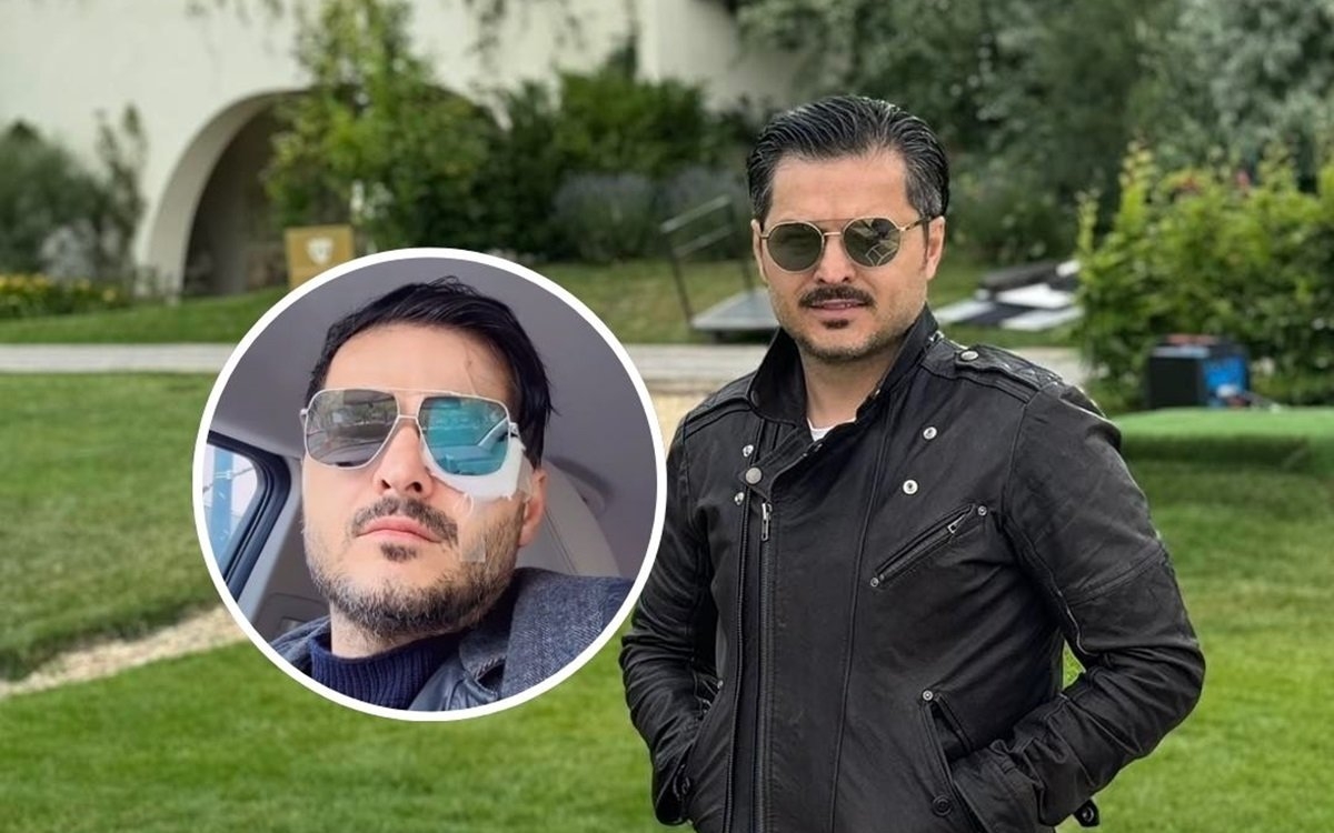 Liviu Vârciu, cu ochiul bandajat pe internet. De ce a ajuns vedeta pe mâinile medicilor