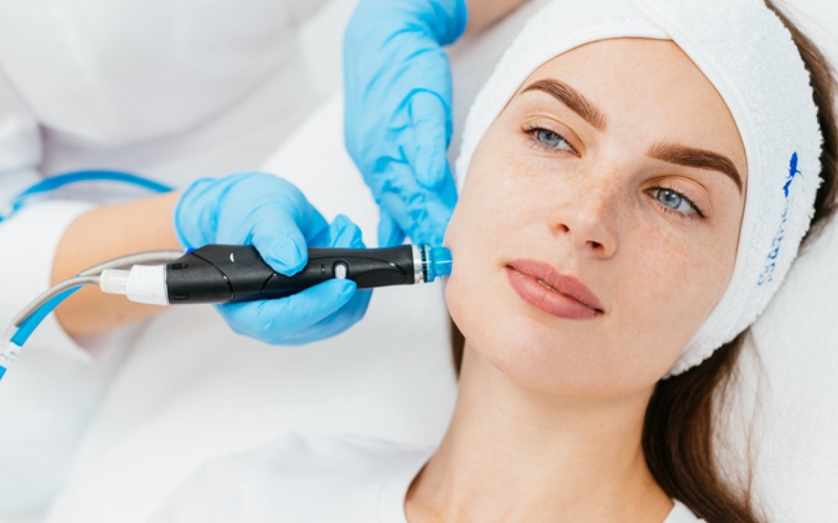 Microneedling cu radiofrecvență: beneficii și recomandări