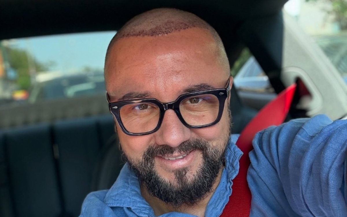 Cătălin Măruță și-a făcut din nou implant de păr. A vorbit fără perdea despre intervențiile făcute de-a lungul timpului