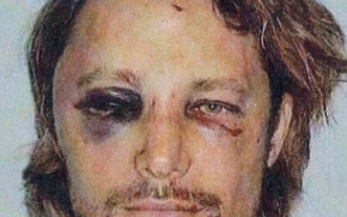 Olivier Martinez l-a batut pana si-a rupt mana