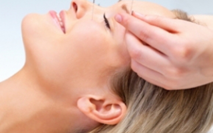 Acupunctura – relaxare si vindecare