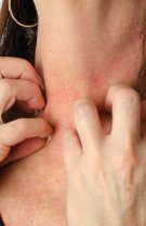 Dermatită de contact
