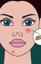 8. Acarienii care mănâncă sebum trăiesc pe fețele noastre