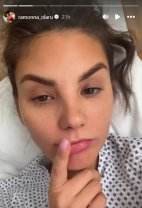 Ramona Olaru a ajuns pe masa de operație. "Mi-a luat tensiunea și mi-a zis..." Inițial nu le-a zis fanilor la ce intervenție avea să fie supusă