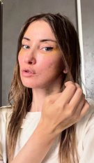 Iulia Albu și-a făcut lifting facial la 44 de ani. Cum arată după operație: „Fără filtre, fără vrăjeală”. A povestit toată experiența pe internet
