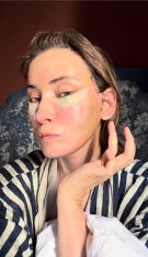 Iulia Albu și-a făcut lifting facial la 44 de ani. Cum arată după operație: „Fără filtre, fără vrăjeală”. Nu vrea să aibă semne de îmbătrânire pe chip
