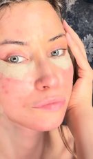 Iulia Albu și-a făcut lifting facial la 44 de ani. Cum arată după operație: „Fără filtre, fără vrăjeală”. A povestit de ce a decis să se opereze