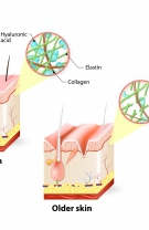 3. Acid hialuronic