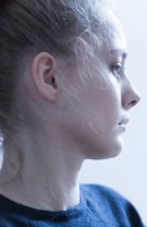Sindromul Sjogren