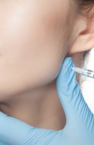 Microneedling