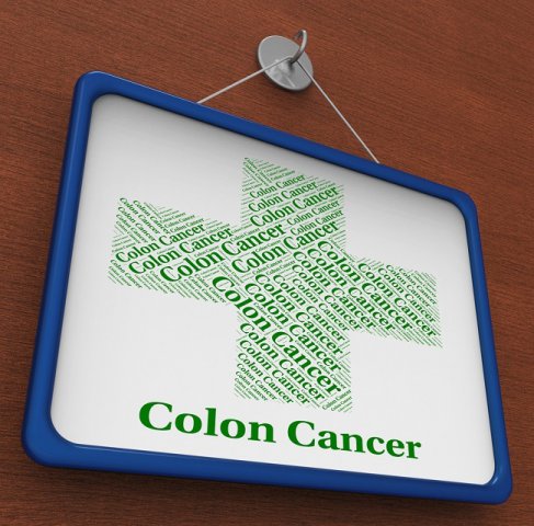 Cancer la colon