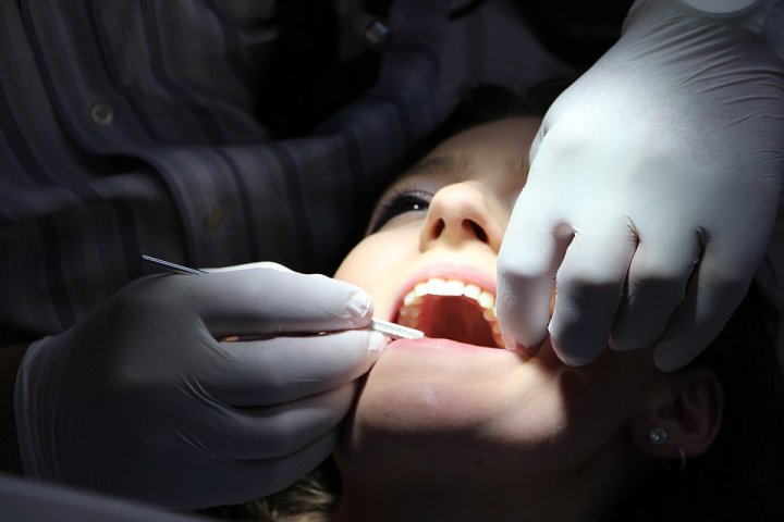 Pierderea dinților și gingii inflamate