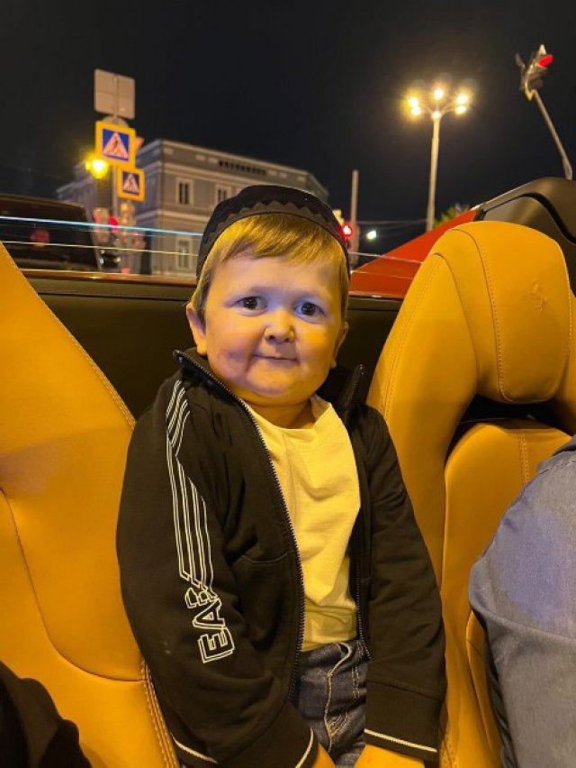 Tânărul rus și Lionel Messi s-au născut cu aceeași boală