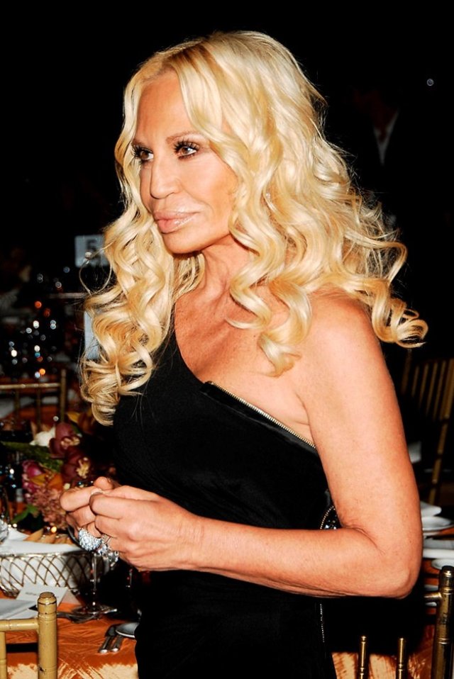 Donatella Versace are botox în obraji