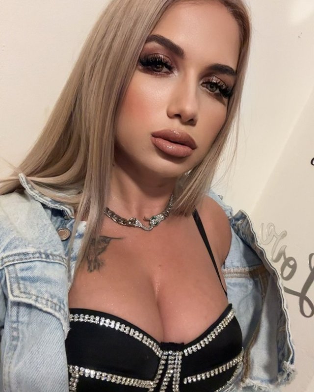 Maria Covașă de la Insula Iubirii și-a pus acid în buze